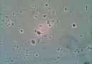 Amoeba dysenteria. Описание на опасен паразит