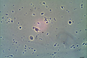 Amoeba dysenteria. Описание на опасен паразит Amoeba dysenteria. Описание на опасен паразит